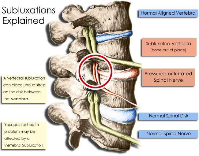 Chiropractor To Children And Adults In Pleasantville NY And Westchester 